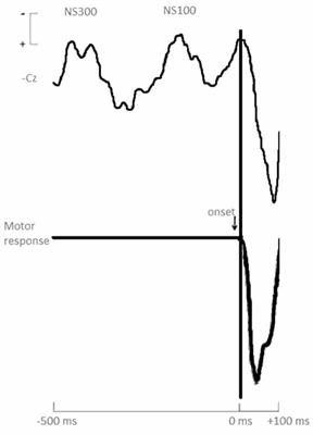 Limitations of Standard Accessible Captioning of Sounds and Music for Deaf and Hard of Hearing People: An EEG Study